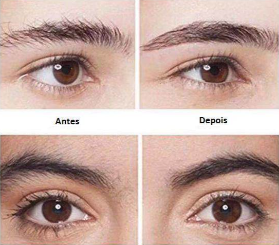 Caneta Depiladora DepiiFace Pro - Versatilidade, Segurança e Precisão na sua Deplilação